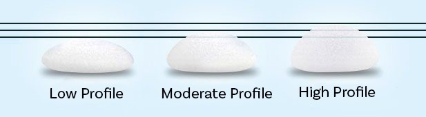 Low Profile vs. Moderate Profile vs. High Profile sizing of breast implants